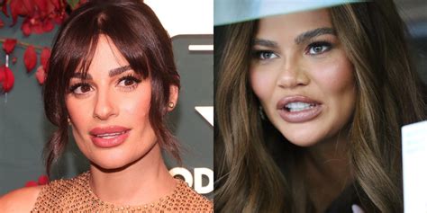 Celebrities Are Doing Buccal Fat Removal: Risks, Benefits